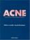 Cover of: Acne
