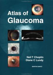 Cover of: Atlas of Glaucoma