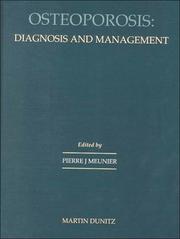 Cover of: Osteoporosis: Diagnosis and management