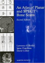Cover of: Atlas of Planar and SPECT Bone Scans