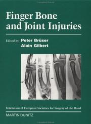 Cover of: Finger Bone and Joint Injuries | Peter BrГјser
