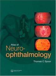 Atlas of neuro-ophthalmology by Thomas C. Spoor
