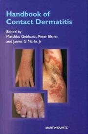 Cover of: Handbook of Contact Dermatitis by Matthias Gebhardt, Peter Elsner, James G. Marks