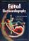 Cover of: Fetal Electrocardiography (Series in Cardiopulmonary Medicine)