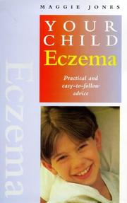 Cover of: Eczema by Jones, Maggie.