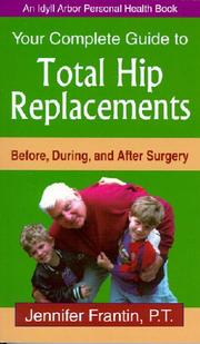 Cover of: Your Complete Guide To Total Hip Replacements by Jennifer Frantin