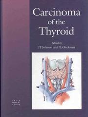 Cover of: Carcinoma of the Thyroid