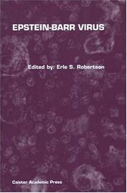 Cover of: Epstein-Barr Virus by Erle S. Robertson