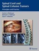 Spinal Cord and Spinal Column Tumors by Curtis A. Dickman, Ziya L. Gokaslan, Michael G. Fehlings