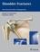 Cover of: Shoulder fractures