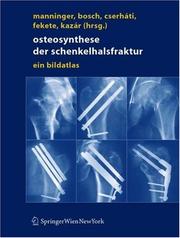Cover of: Osteosynthese der Schenkelhalsfraktur: Ein Bildatlas