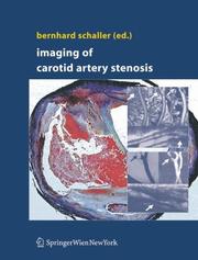 Cover of: Imaging of Carotid Artery Stenosis