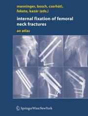 Cover of: Internal fixation of femoral neck fractures: An Atlas