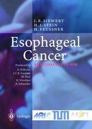 Cover of: Esophageal Cancer