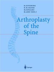 Arthroplasty of the spine by Robert Gunzburg
