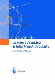 Cover of: Ligament balancing in total knee arthroplasty by Leo A. Whiteside, editor.