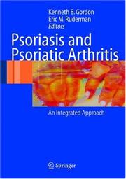 Psoriasis and psoriatic arthritis