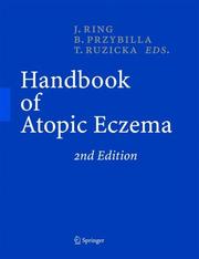 Cover of: Handbook of Atopic Eczema by 
