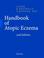 Cover of: Handbook of Atopic Eczema