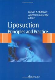 Cover of: Liposuction: Principles and Practice