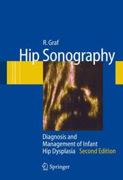 Cover of: Hip Sonography: Diagnosis and Management of Infant Hip Dysplasia