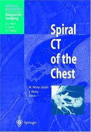 Cover of: Spiral CT of the Chest