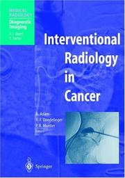 Cover of: Interventional Radiology in Cancer