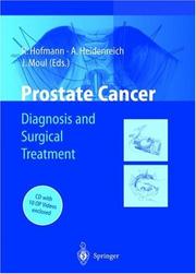 Cover of: Prostate Cancer by A. Heidenreich, J. W. Moul