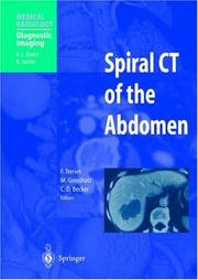 Cover of: Spiral CT of the Abdomen