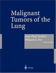 Malignant tumors of the lung by Jean-Paul Sculier, Willard A. Fry