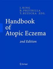 Cover of: Handbook of atopic eczema by T. Ruzicka, J. Ring, B. Przybilla (eds.).