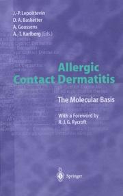 Cover of: Allergic contact dermaritis: the molecular basis