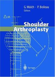 Shoulder arthroplasty