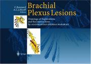 Brachial plexus lesions