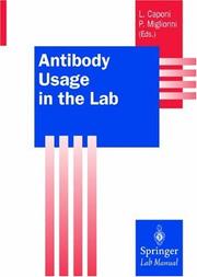 Antibody usage in the lab by Paola Migliorini