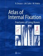 Cover of: Atlas of Internal Fixation by R. Orozco, J.M. Sales, M. Videla