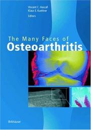 Cover of: The Many Faces of Osteoarthritis (Methods & Tools in Biosciences & Medicine)