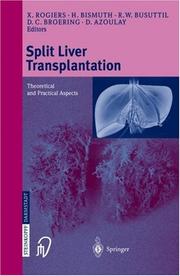 Cover of: Split-Liver Transplantation