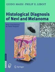 Cover of: Histological Diagnosis of Nevi and Melanoma