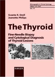 Cover of: The Thyroid: Fine-Needle Biopsy and Cytological Diagnosis of Thyroid Lesions (Monographs in Clinical Cytology)
