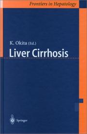 Cover of: Liver Cirrhosis