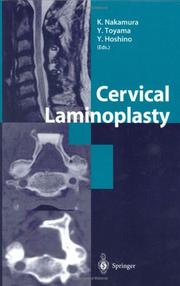 Cover of: Cervical Laminoplasty by Kozo Nakamura, Yoshiaki Toyama, Yuichi Hoshino