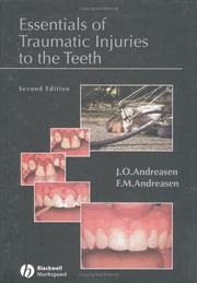 Cover of: Essentials of Traumatic Injuries to the Teeth: A Step-by-Step Treatment Guide