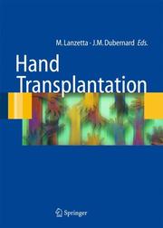 Cover of: Hand transplantation