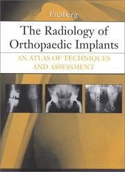 Cover of: The Radiology of Orthopaedic Implants by Andrew A. Freiberg