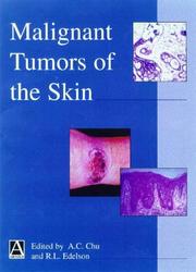 Cover of: Malignant Tumors of the Skin