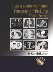 Cover of: High-resolution Computed Tomography of the Lungs: A Pattern Approach Includes CD-ROM