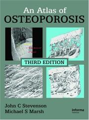 Cover of: Atlas of Osteoporosis, Third Edition (Encyclopedia of Visual Medicine)