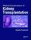 Cover of: Medical Complications of Kidney Transplantation