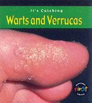 Cover of: Warts and Verrucas (Its Catching) by Angela Royston